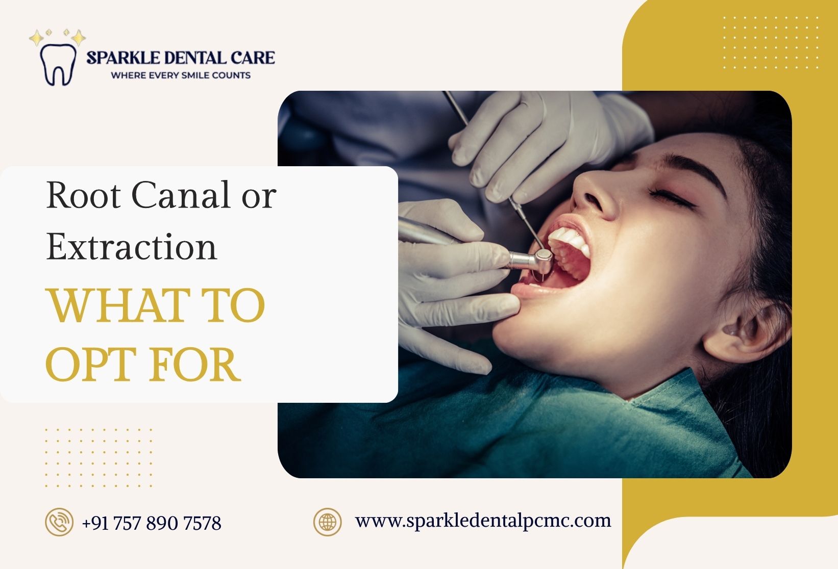 Root Canal or Extraction: What to opt for?