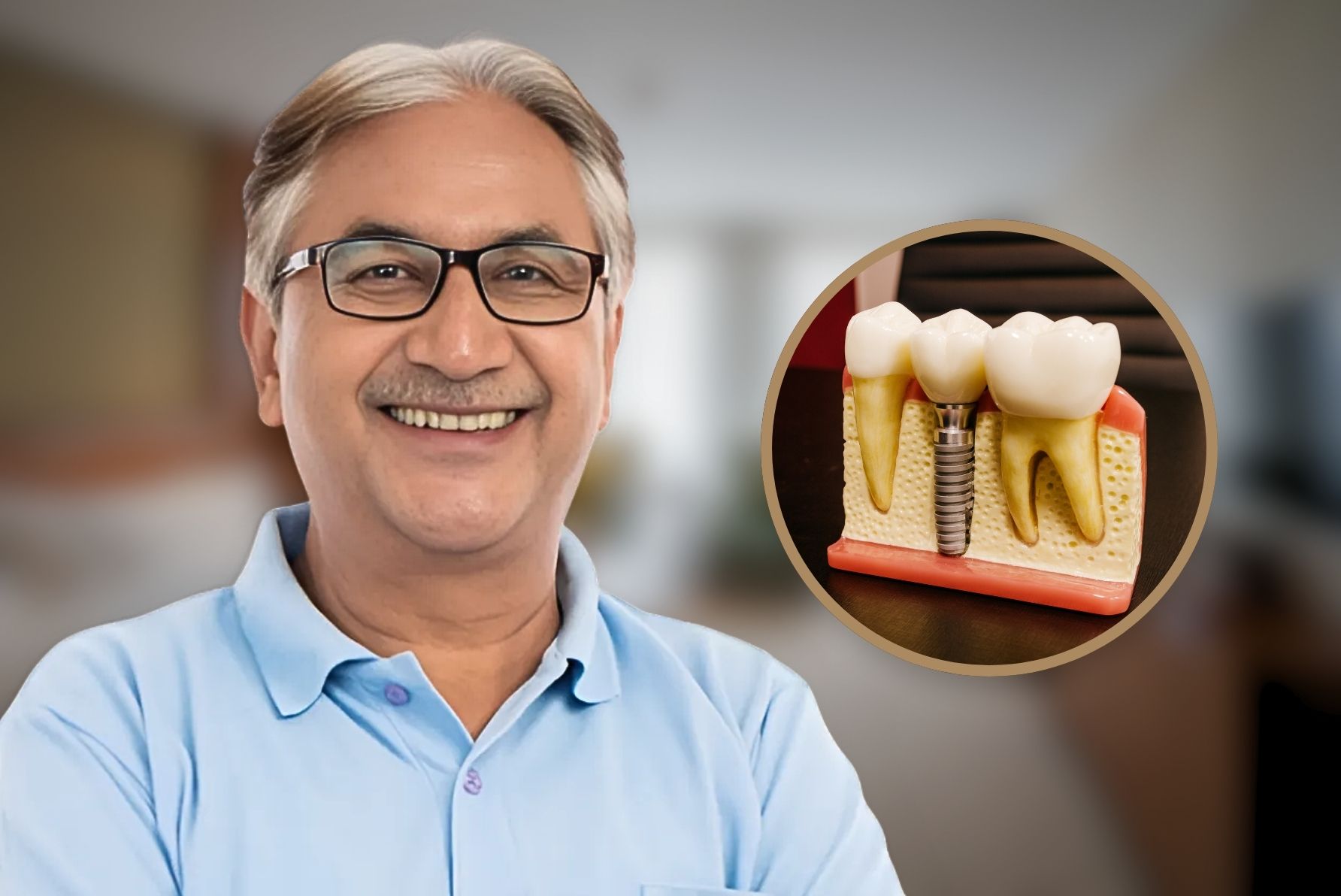 Dental Implants in Pimpri, Pune 