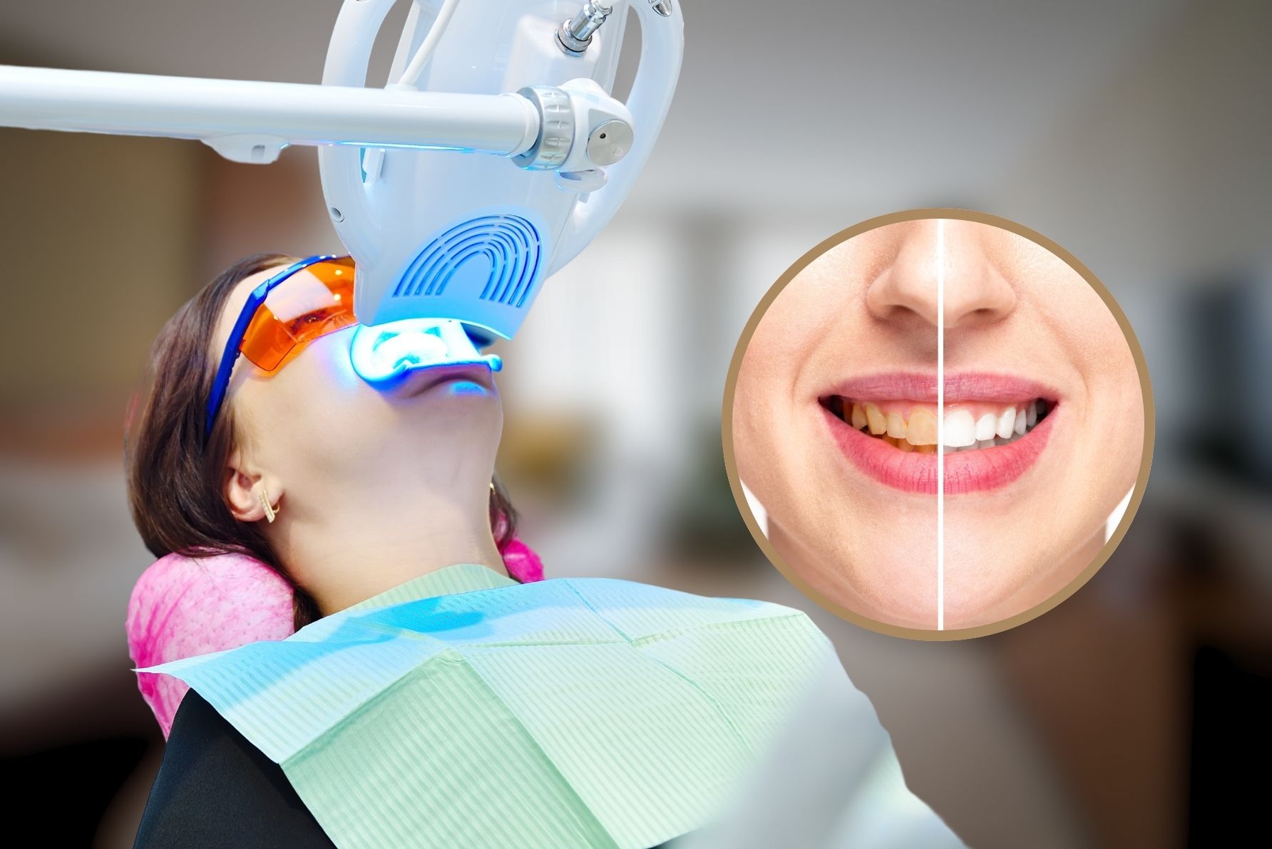 Teeth Whitening in Pimpri, Pune