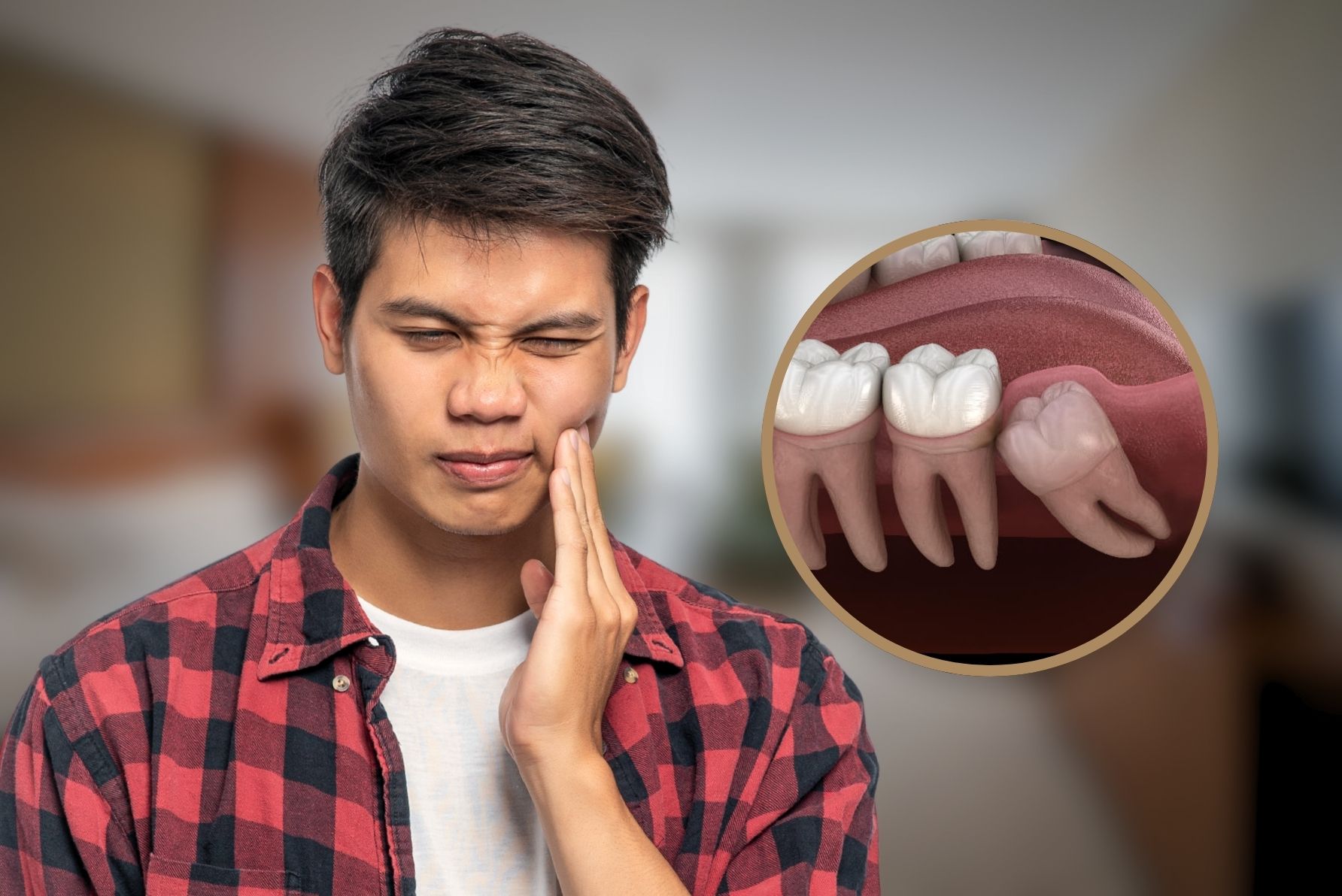 Wisdom Tooth Removal in Pimpri, Pune
