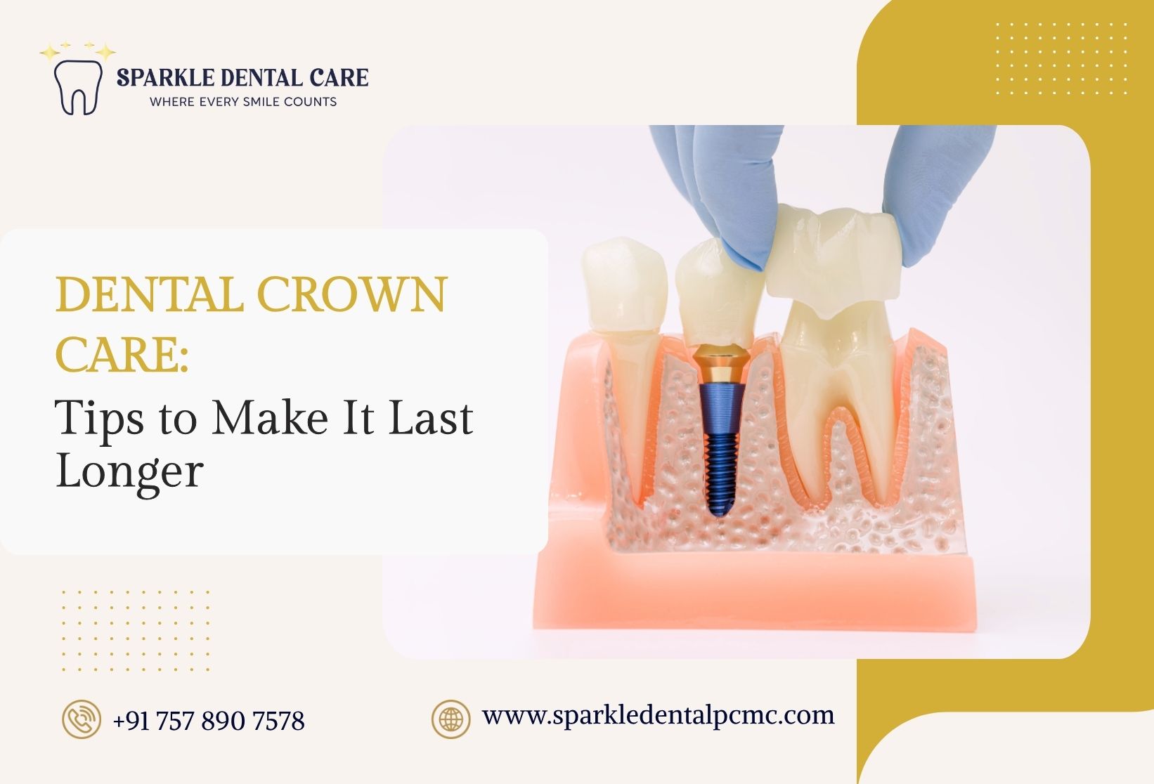 Dental Crown Care: Tips to Make It Last Longer